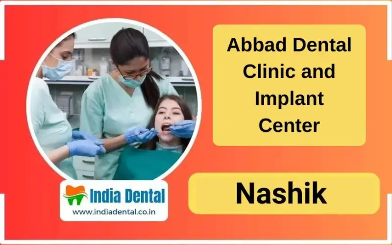 Abbad Dental Clinic and Implant Center – Your Trusted Smile Partner in Nashik