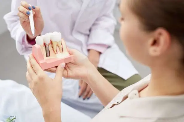 Dental Implants