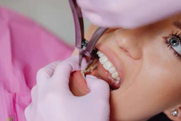 Root Canal Treatment